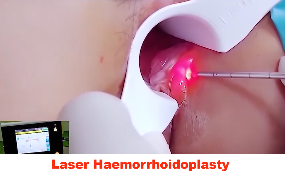 Laser Surgery Theatre at SaveALife Mission Hospital